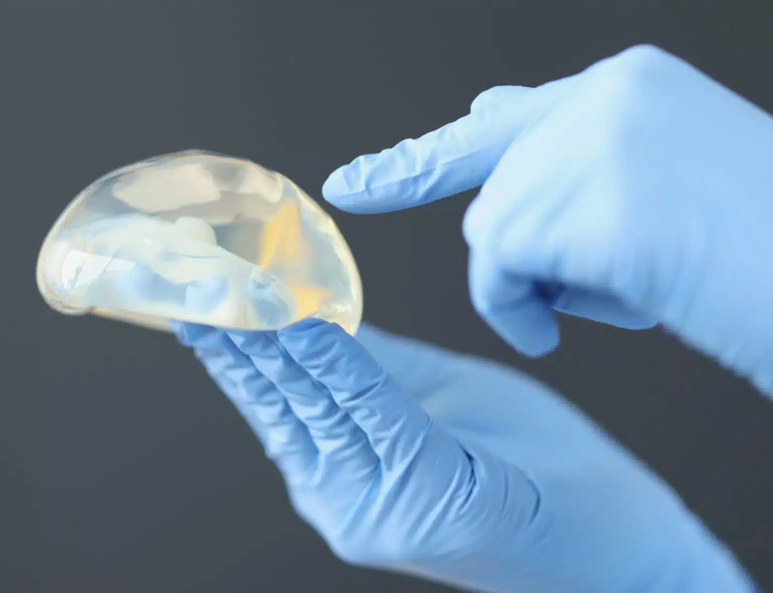 Breast augmentation with fat or implants