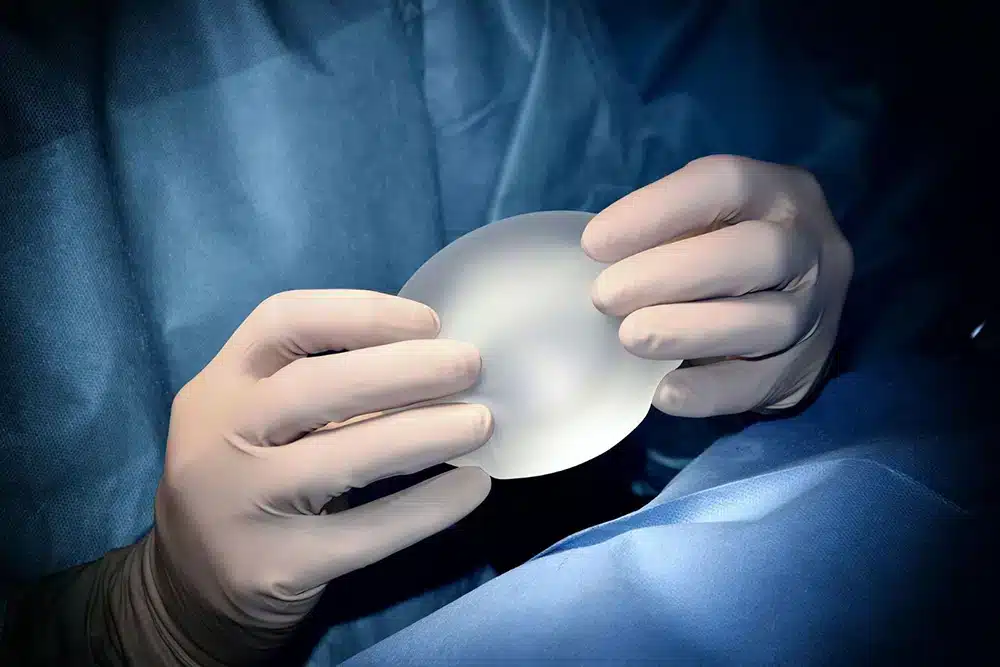 Breast augmentation with fat or implants