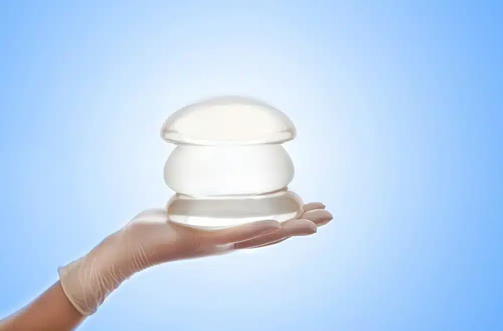 Breast augmentation with fat or implants