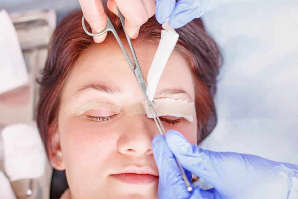 blepharoplasty