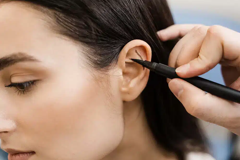 Otoplasty Surgery