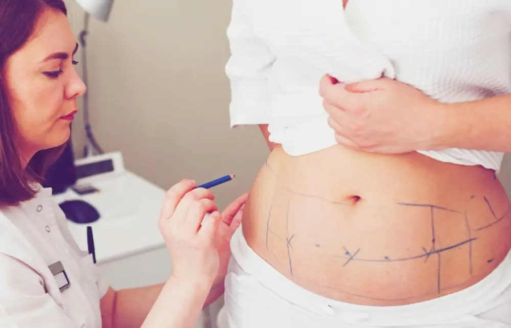 Postpartum body cosmetic surgery