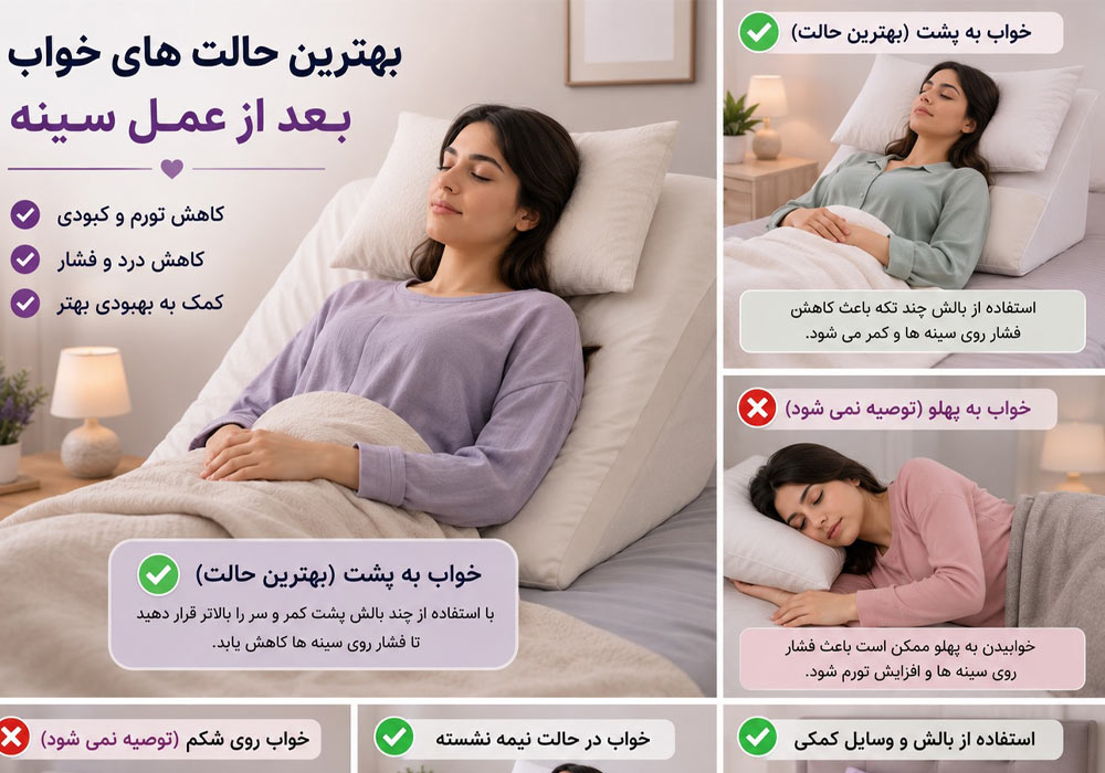 Sleeping position in the first days after breast surgery