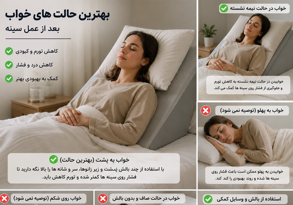 Sleeping position in the first days after breast surgery