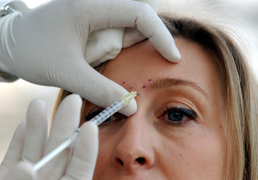 The Effect of Facial Muscle Structure on the Results of Botox Injections