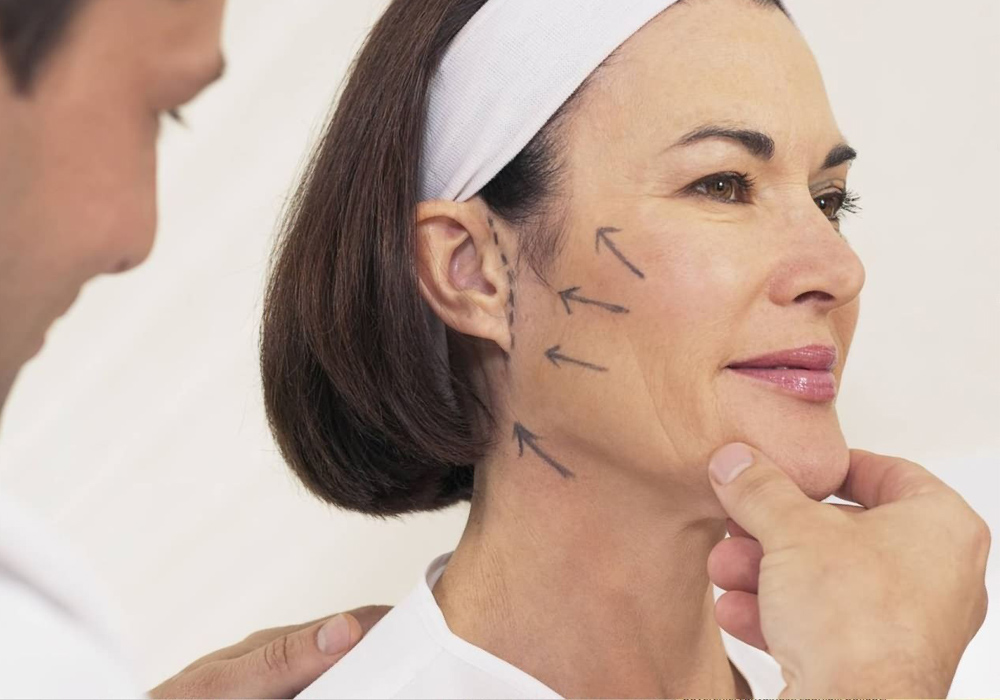Essential Care Tips to Extend the Longevity of a Facelift