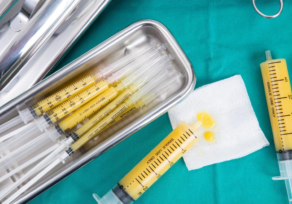Reasons Why Some Fat Is Reabsorbed After Fat Injection