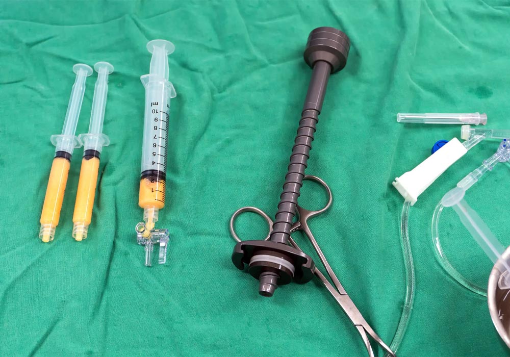Reasons Why Some Fat Is Reabsorbed After Fat Injection