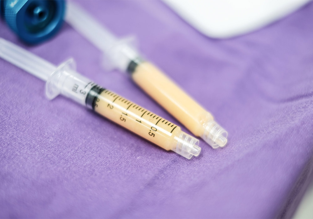 Reasons Why Some Fat Is Reabsorbed After Fat Injection