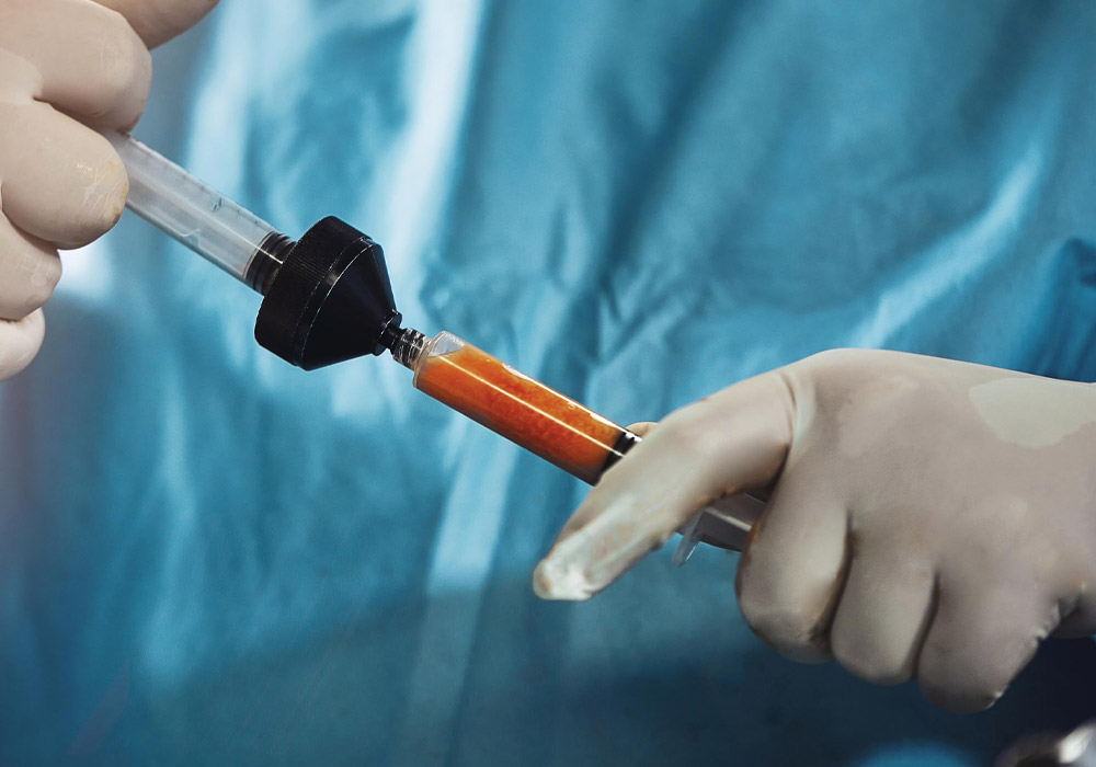 Reasons Why Some Fat Is Reabsorbed After Fat Injection