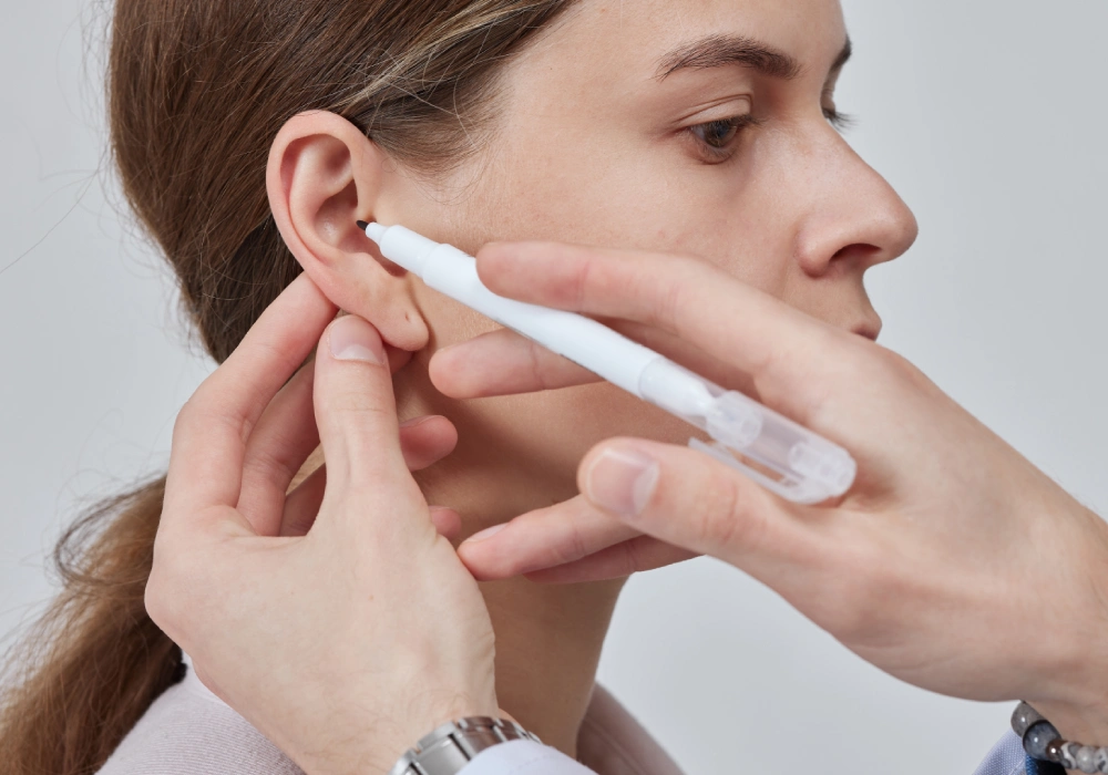 Treatment of Ear Deformities with Advanced Otoplasty Techniques