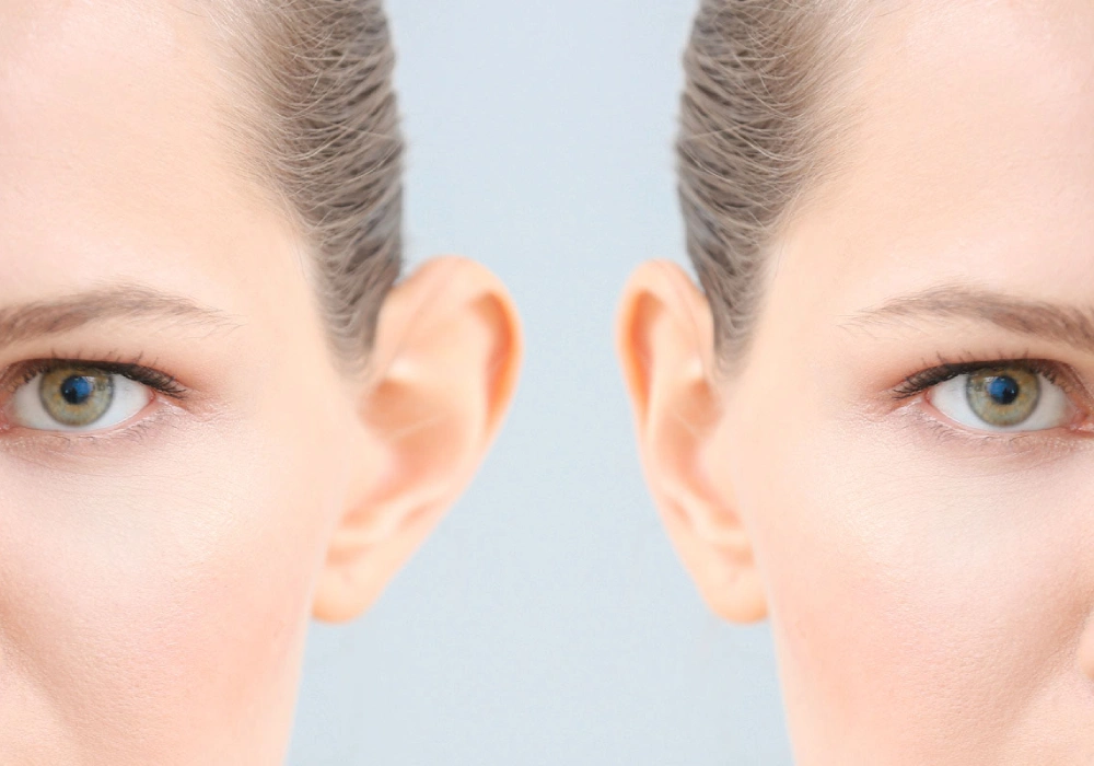 Treatment of Ear Deformities with Advanced Otoplasty Techniques
