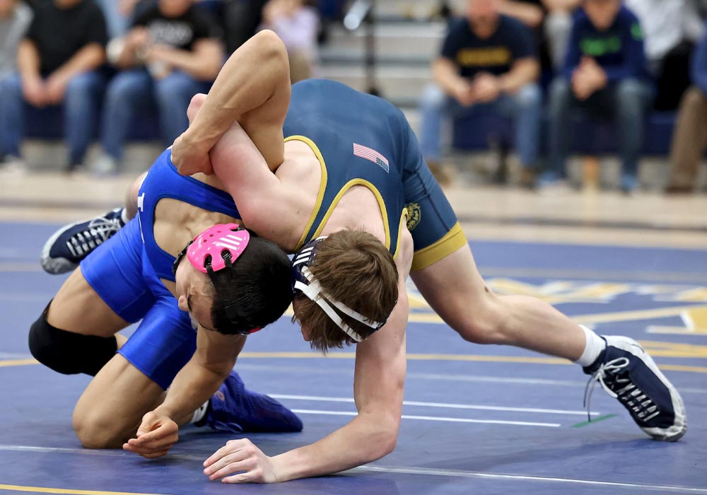 The Impact of Sports Injuries on the Results of Ear Cosmetic Surgery