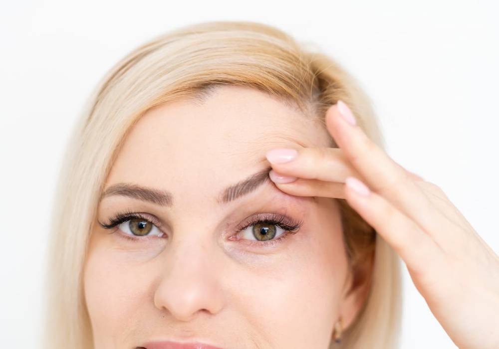 Eyelid drooping after Botox