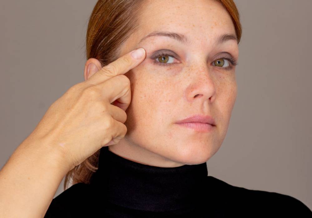 Eyelid drooping after Botox