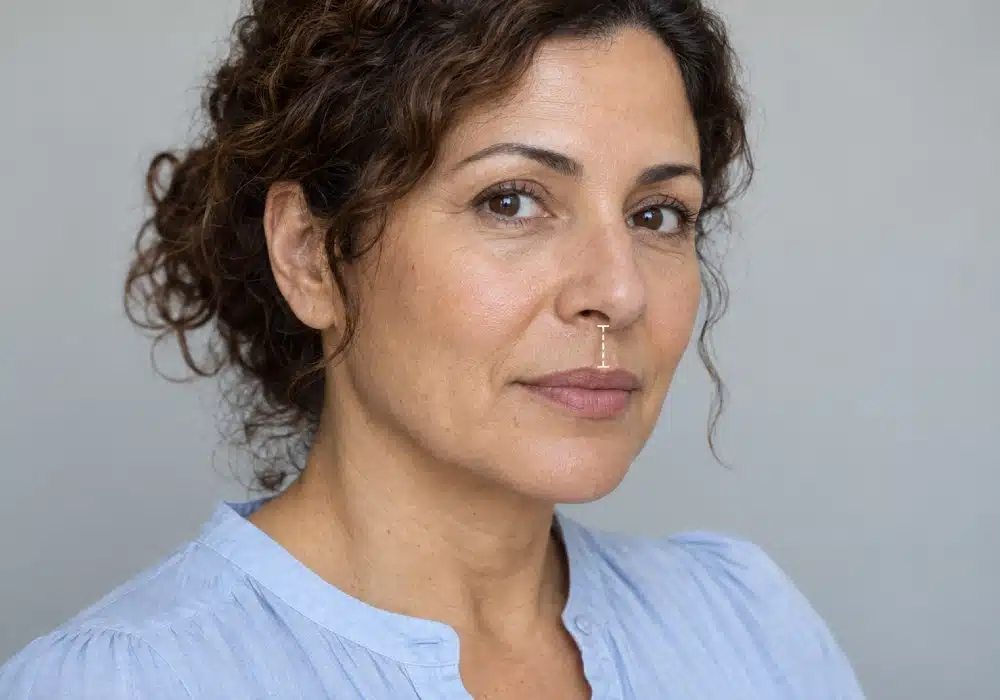 Comparison of Central Lip Lift and Lip Filler Injection